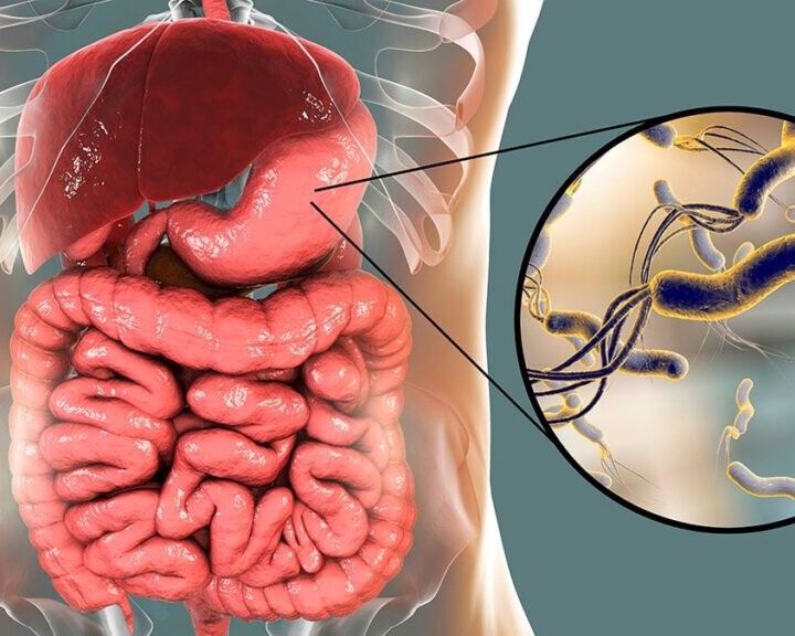 helicobácter pylori
