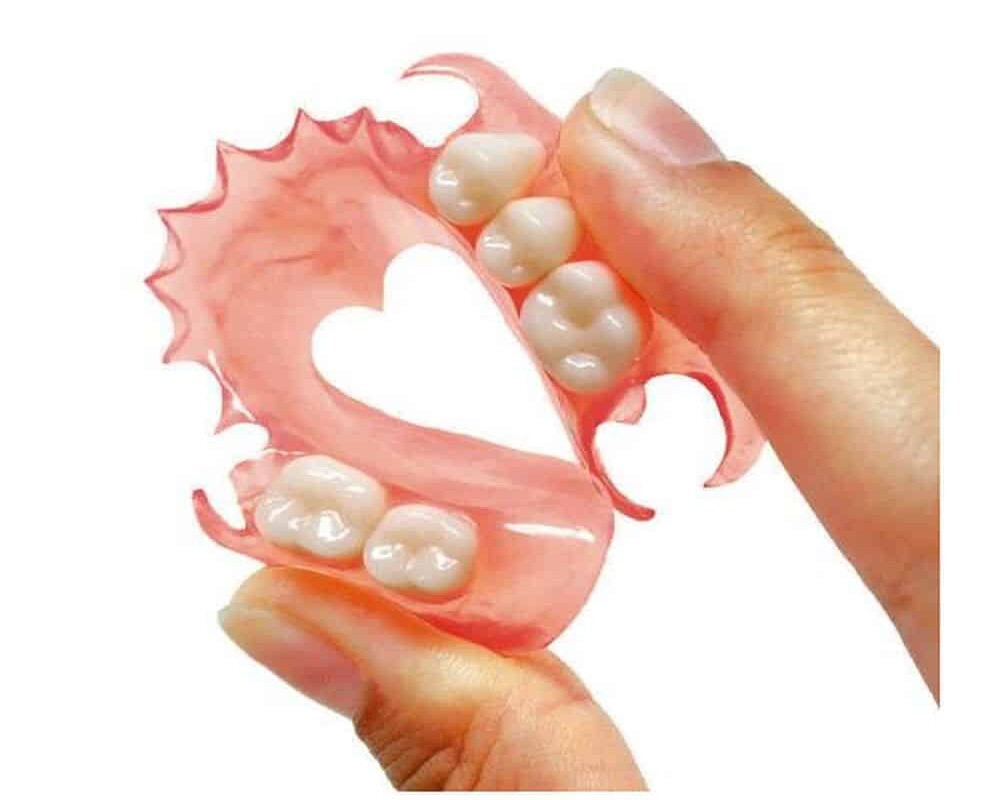 prótesis dentales removibles sin ganchos